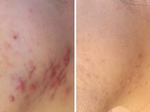 サロンドラッジ(Salon de Raggi)/【IPLフェイシャル】