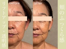 健志接骨院/πテラピー造顔メソッド