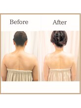 サロンルーチェ(Salon Luce)/50代ビフォーアフター/施術12回