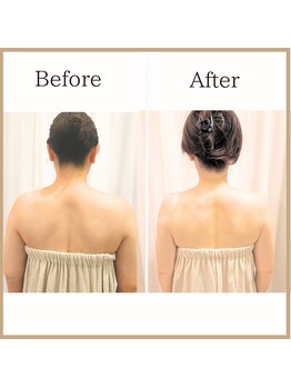 サロンルーチェ(Salon Luce)/50代ビフォーアフター/施術12回