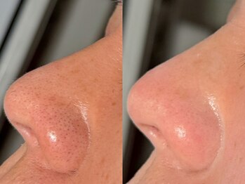 ルーナジェーナ(Luna llena)/