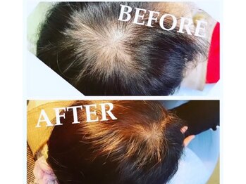 徳島美容サロン/強髪コース