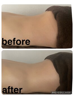 ギンザアール(GINZA R.)/腰痛ケア！