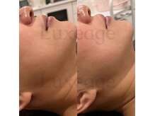 プライベートサロン ルクサージュ(Luxeage)/結果重視の丁寧な施術