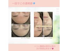 フェイシャルサロン シェリー(cherie)の雰囲気（プラチナ×乳酸×レチノヒアルロン酸で自発光ピーリング♪）