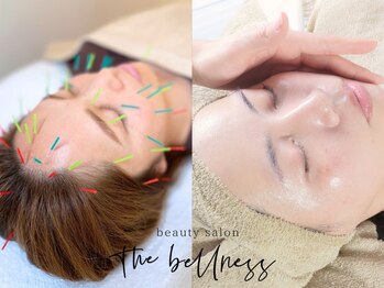 ザ ベルネス(The bellness)の写真/今話題！《美容鍼が初心者の方におすすめ♪》痛みの少ない「優しい鍼」で【小顔×肌質改善】
