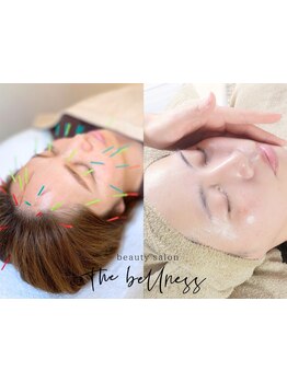 鍼灸施術を受けたい