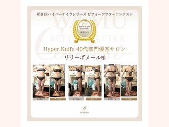 リリー ボヌール(Lily bonheur)/Before&After Contest