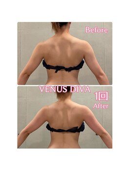 エクセレントビューティーサロン 艶(EN)/ブライダル 1回