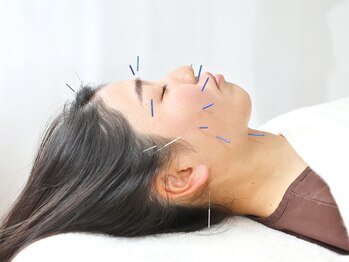 サンズイ(SANZUI)/お顔の鍼灸