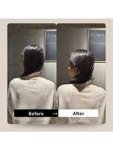 カーム整骨院(CALM整骨院)/寝違いには早めの施術を