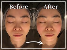 R-1ビューティーサロン 銀座/Before&After