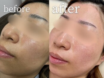 【まつげパーマ/眉毛/HBL/フェイシャルワックス専門店】C.（シードット）神戸三宮店/フェイシャルwaxは即効性が◎