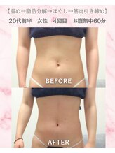 リラ(Lilas)/【痩身】ぺったんこお腹に変身