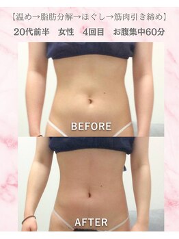リラ(Lilas)/【痩身】ぺったんこお腹に変身