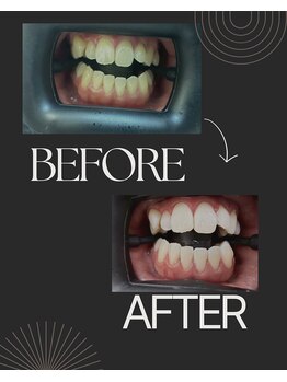 セルフダック 栃木小山店(SELFDUCK)/30代 男性