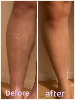 シアンビビ(Cyaan bibi)/men's （Lパーツ）