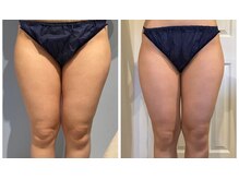 ルナグランデ(Luna grande.)/回数を重ねると別人級に