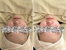 マヴィ 香里園店(MavY.)/水光肌になりましょう