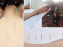 美巡究 南麻布の雰囲気(お悩みにしっかりアプローチ。刺激量は調節出来ます #ツボ#鍼灸)