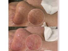 アンドアール(and R)の雰囲気(長年の毛穴汚れは当店へお任せください♪)