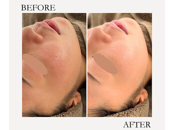 イオ(‘IO)/ノーファンデアンプル