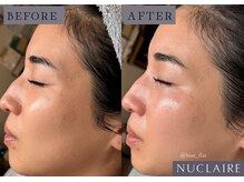 フーフラット(Huu flat)/ワックス×ハーブ