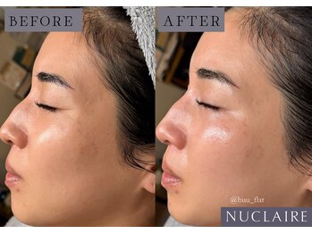 フーフラット(Huu flat)/ワックス×ハーブ