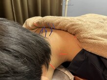 茅場町鍼灸マッサージ整骨院