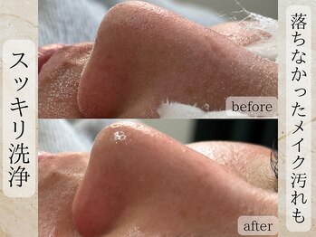 ライリー(Rairy)/スッキリ毛穴洗浄♪