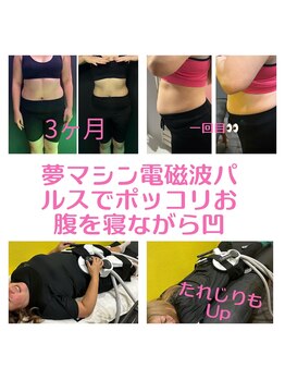 サロンジム(SalonGym)/電磁パルス