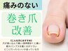 【初回検査今だけ無料で実施中!】巻き爪改善
