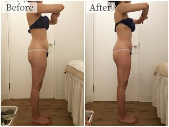 ボーレーヴ(beau reve)/ブライダル/インディバ/痩身