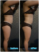 ラクラク(rakuraku)/痩身【全身】９０分（１回目）