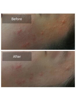 オーガニック アンド ビューティー シアン(CYAN.)/ビフォーアフター