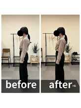 熊本カワル整体 JR上熊本駅院/猫背・巻き肩