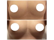 エステサロン ラ ボーテ(La Beaute)の雰囲気（最新バスト機器で根本改善！お胸が育つ身体作り。育乳・バストUP）