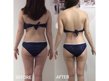 エスグレース 梅田店(S.grace)/痩身施術ダイエット！