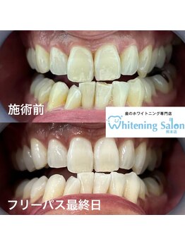 ホワイトニングサロン 熊本店/街中ホワイトニング