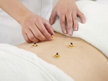 はらだ指圧整体マッサージ治療室/灸の温熱効果で血行改善☆