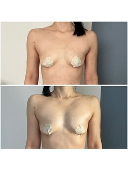 モア(moa)/いくつになっても諦めないで!