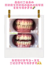 ルブラン 奈良店(Le Blanc)/無料カウンセリング！