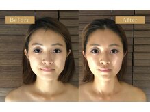 グレースフィオーレ(gracefiore)の雰囲気（頭蓋骨小顔矯正☆累計36万人が実感！結果重視の小顔矯正♪）