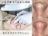【毛穴汚れごっそり！即効性☆いちご鼻解消】毛穴エクストラクション120分
