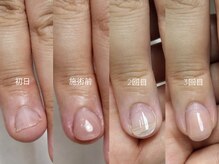 ミンスネイル(Mins Nail)/形がどんどん変わる！