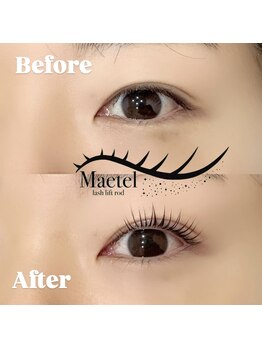 レディエント 北浦和店(Radiant)/メーテルロッド