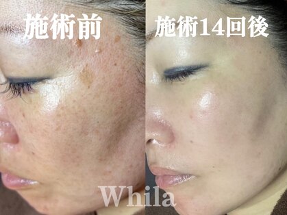 ホワラ 南青山店(Whila)の写真