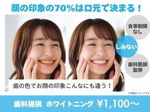 ホワイトニングカフェ 札幌大通店(WhiteningCafe)