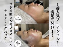 シーフェイス 横浜店(SEE FACE)の雰囲気(フェイスラインが1回で驚くほどスッキリ!ハリツヤアップ!)