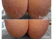 カシェット 広島店(Cachette)/30代女性☆足裏角質ケア90分